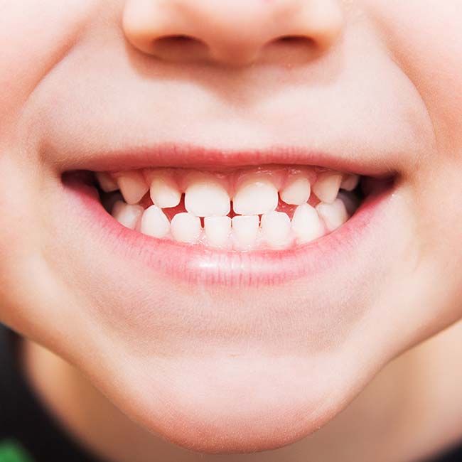 A healthy smile from a child