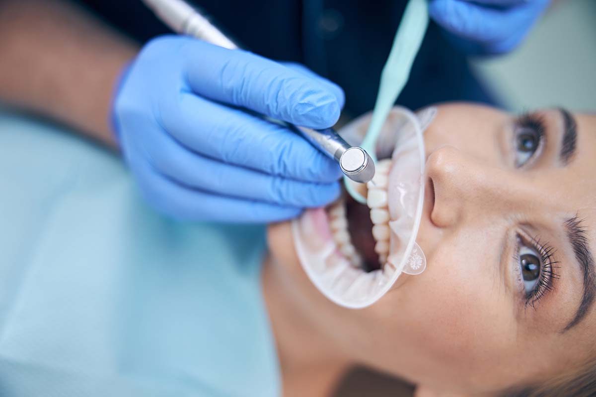 Dental bonding at Dearborn Family Dentistry in Keizer Oregon